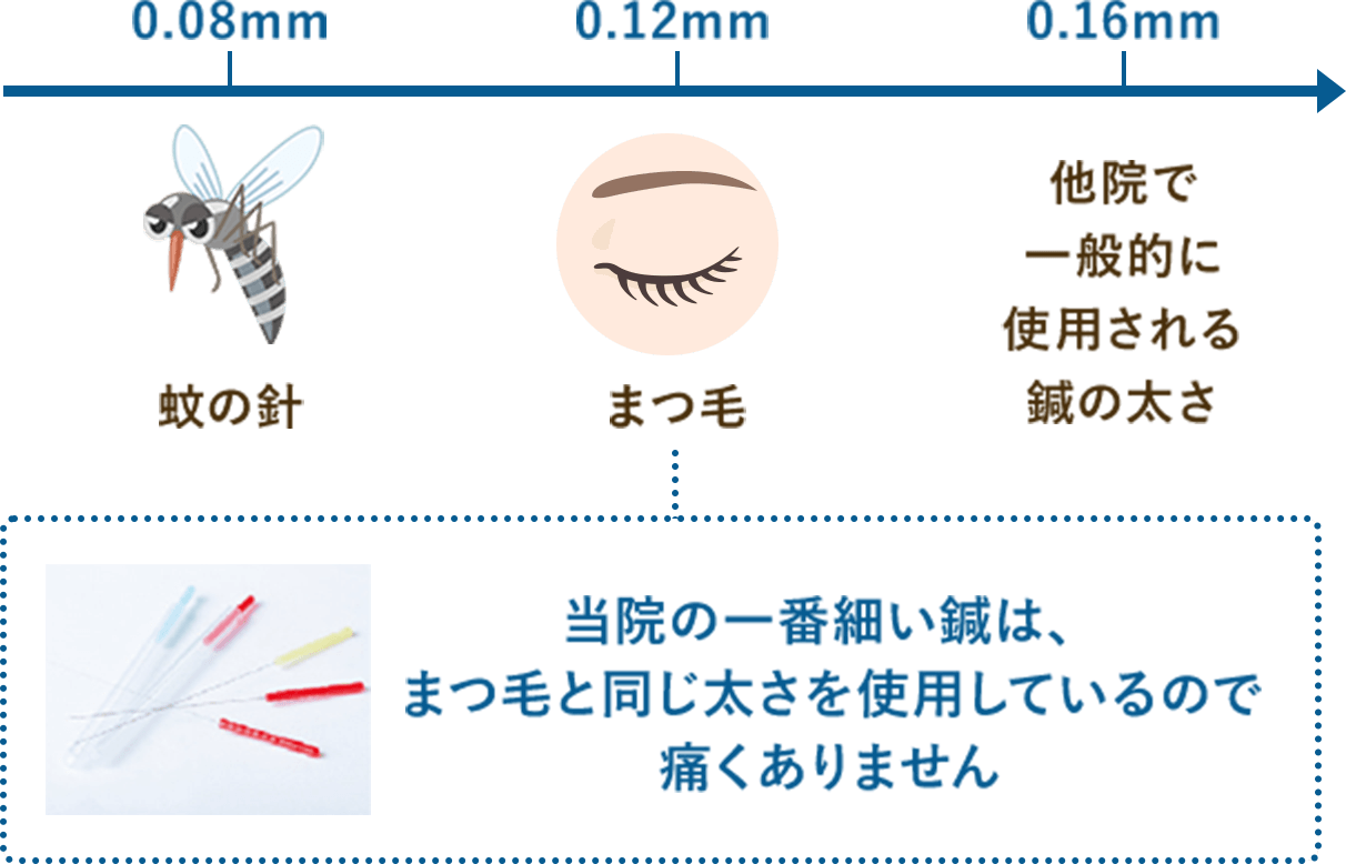 当院の一番細い鍼は、まつ毛と同じ太さを使用しているので痛くありません